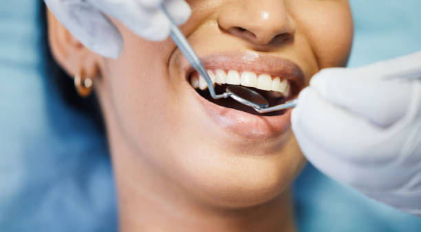 Best Emergency Dentist for Knocked-Out Tooth in Hughesville, MD